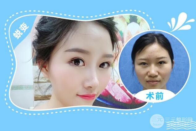 自身皮肤影响价格