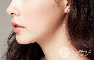 膨体垫下巴果能维持多久 恢复期每个人都不一样~
