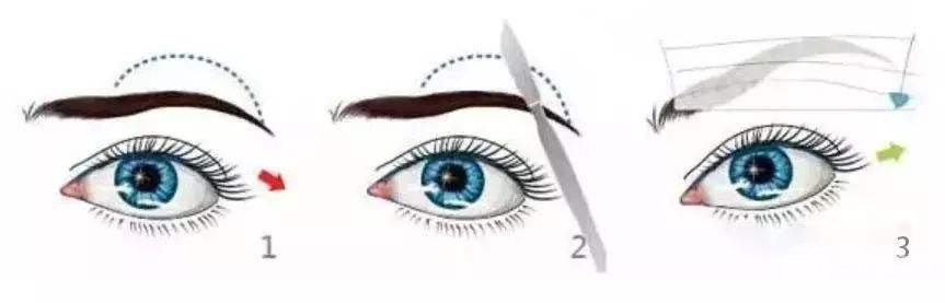 切眉术适合多大年龄做