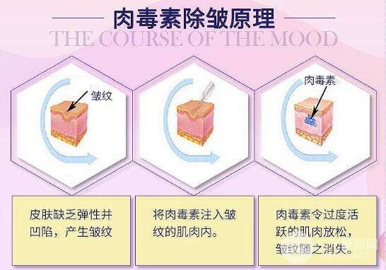 去皱多少钱