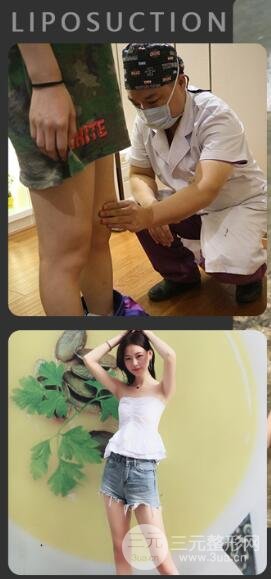 术后注意事项
