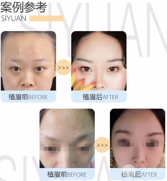 植眉价格贵吗？美眉们的美丽攻略来咯！