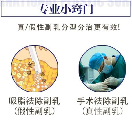 腋下副乳手术技术好不好