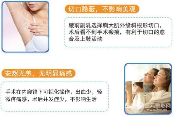 腋下副乳手术多少钱?夏天穿吊带就靠它了!