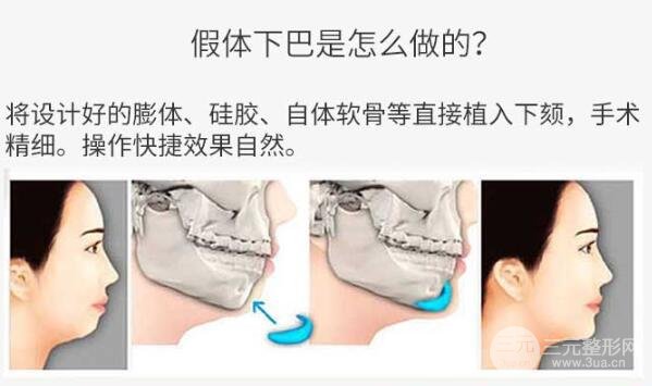 术后果