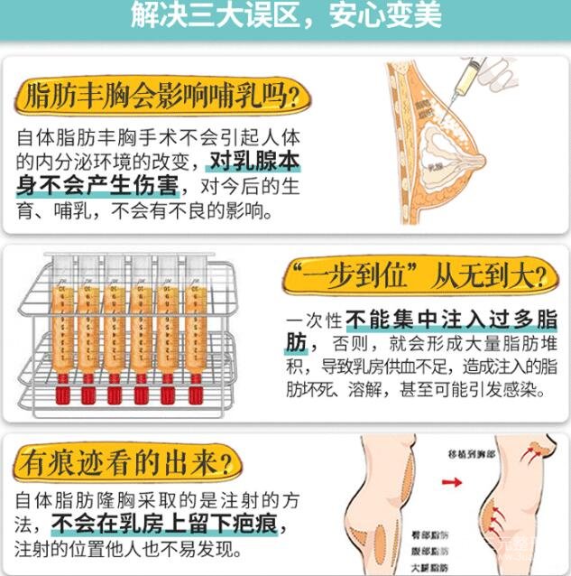 胸太小!自体丰胸的果好不好?能维持多久?
