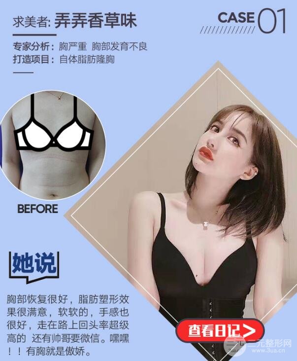 胸太小!自体丰胸的果好不好?能维持多久?