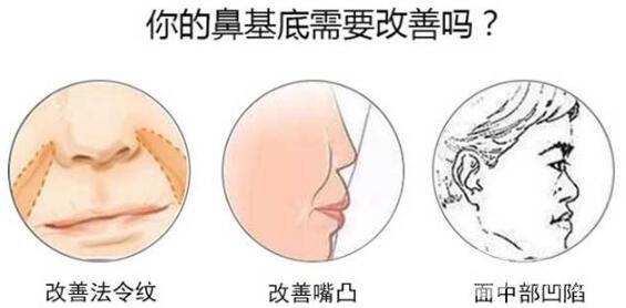 垫鼻基底的3大材料,你对哪个更感兴趣~