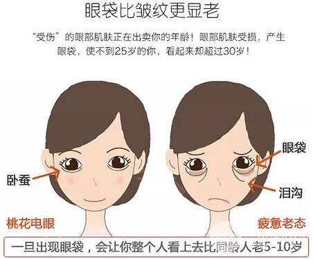 激光去眼袋多少钱？贵吗？别让你的眼袋越变越大！