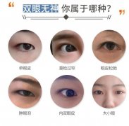 想割双眼皮，这3种方式先来了解一下