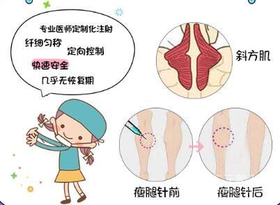 什么是****注射瘦腿?