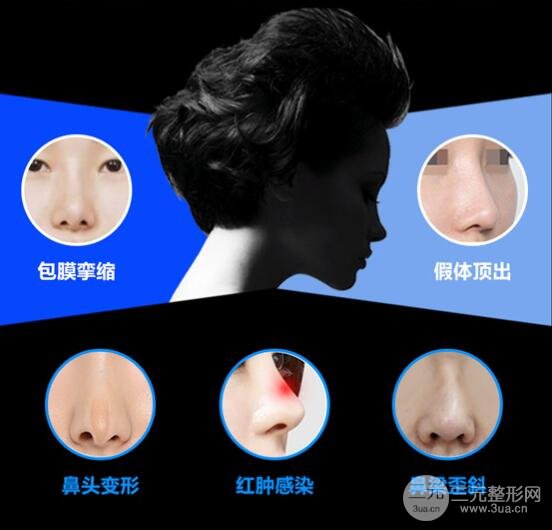 修复鼻子多少钱?
