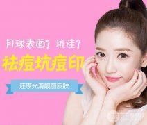 祛痘要多少钱？做一次多少钱？