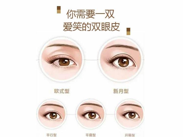 一般做双眼皮多少钱?贫民窟女孩能hold住吗?