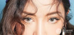 有鱼尾纹该怎么办?这2种常用的医美方法你还不知道?! 有鱼尾纹该怎么办?这2种常用的医美方法你还不知道?!