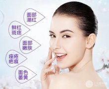 北京光子嫩肤价格贵吗？大概要多少钱呢？