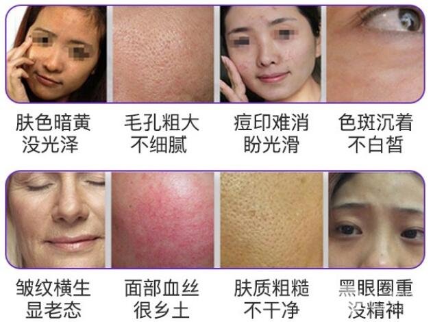 北京光子嫩肤价格贵吗?大概要多少钱呢?