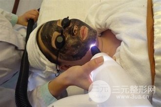 黑脸娃娃美白敏感肌的人可以做吗？