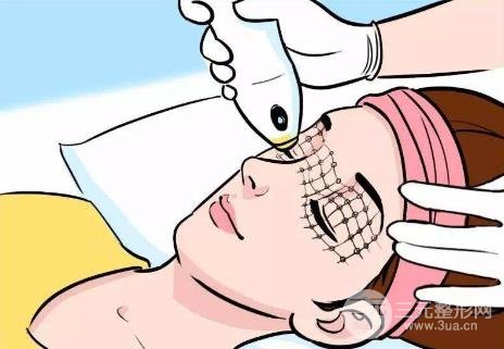 热玛吉工作原理