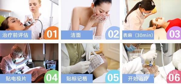 热玛吉的缓解过程