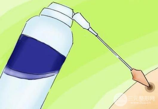 冷冻去痣适应的人群