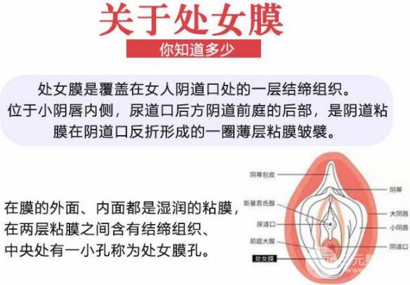 私密|处女膜修补术术后注意事项！