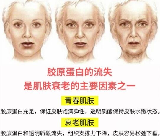 "面部除皱术哪种果好?了解下这几种方式 "