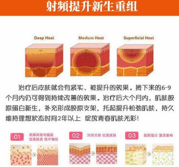 面部除皱术哪种果好?射频怎么样