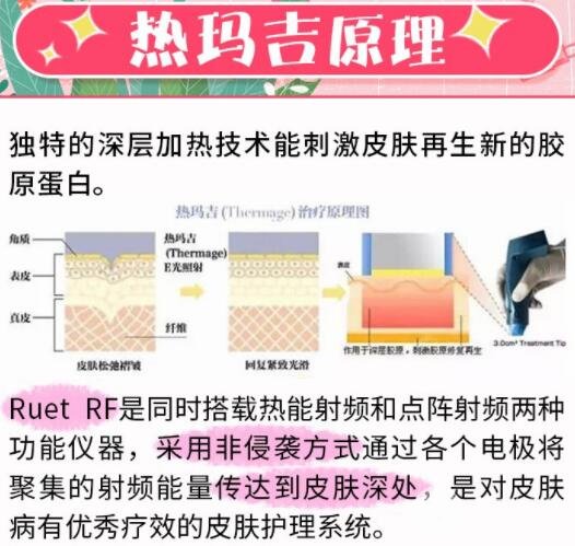 面部除皱术 热玛吉果好不好