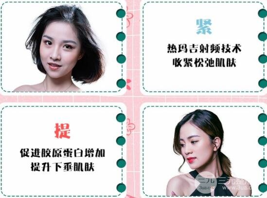 面部除皱术热玛吉果图