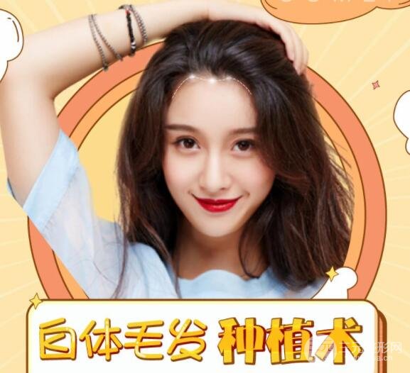 种植头发价格多少钱?告别“阿哥”发型