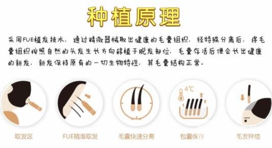 种植头发原理