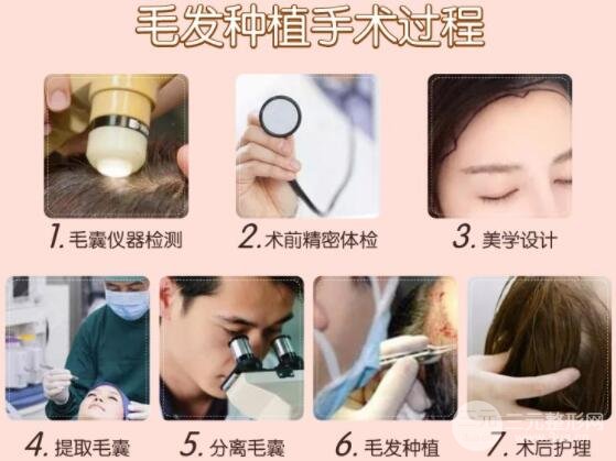 种植头发价格贵吗 手术过程