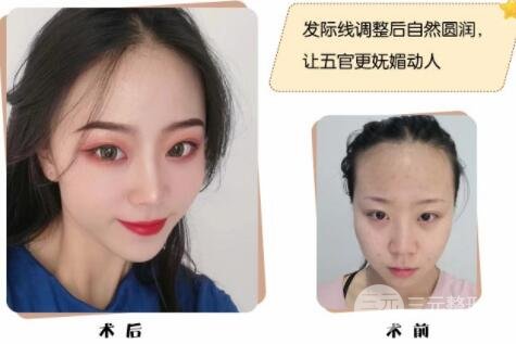 种植头发果图