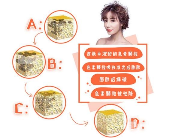 做完黑脸娃娃要注意什么?