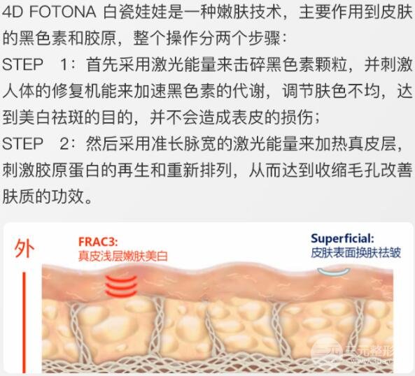 白瓷娃娃多少钱一次，美肤果图~