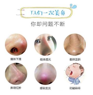 鼻梁假体取出术介绍