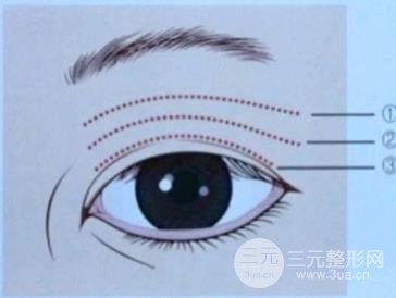 眼窝凹陷怎么办？