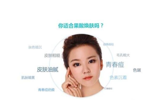 果酸换肤需要多少钱 肌肤的重生之路~