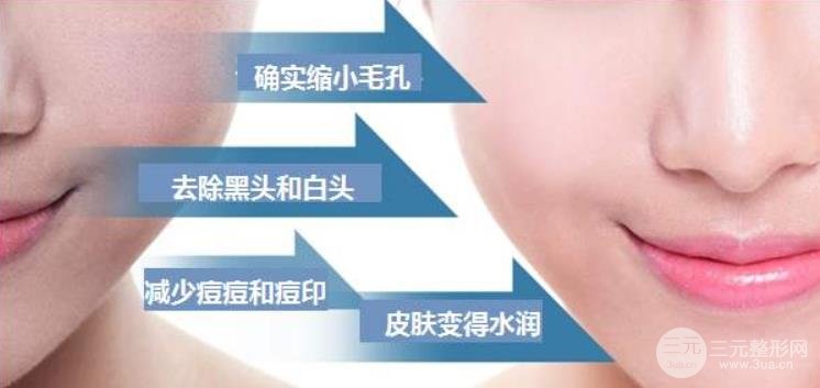 黑脸娃娃什么价格？所有人都适合做黑脸娃娃么~