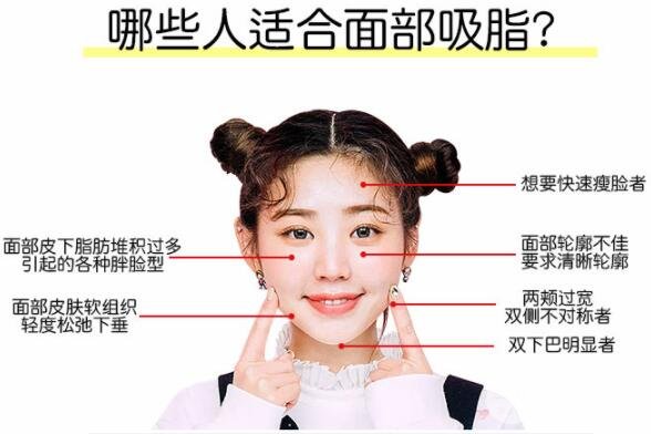 脸部吸脂适合哪些人