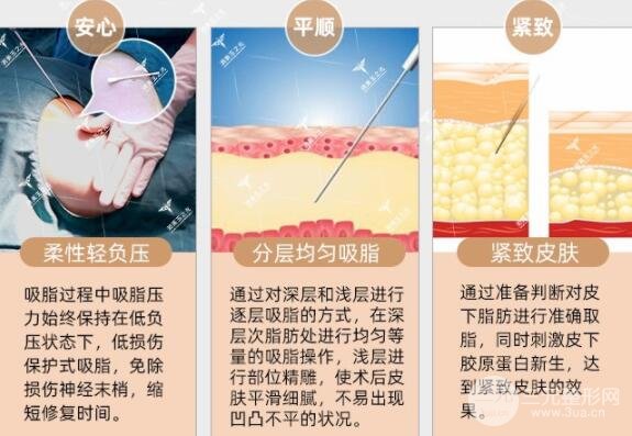 脸部吸脂价格贵不贵,大脸妹们看过来~