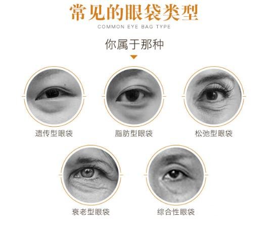 激光去眼袋原理介绍