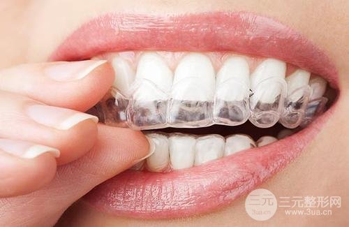 广州牙齿整形医院名单，这几家口碑还不错！