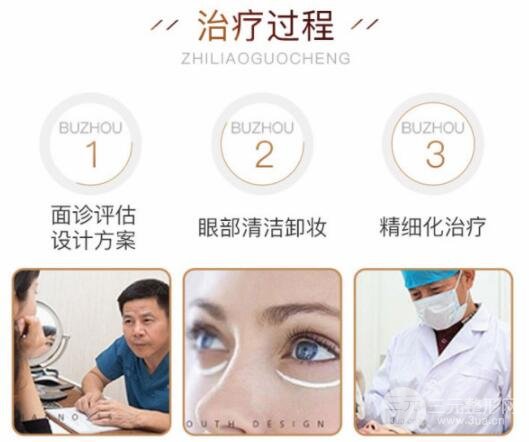 激光去眼袋手术过程