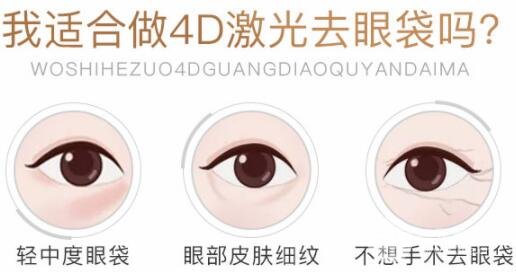 激光去眼袋要多少钱?这价格让人无法拒绝~