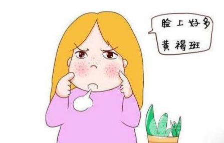 黄褐斑出现的原因