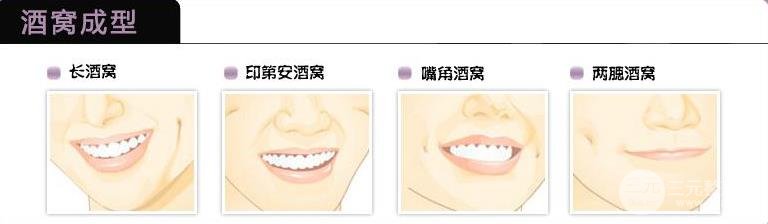酒窝整形后的恢复时间
