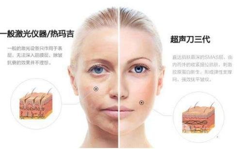 热拉提美容的价格