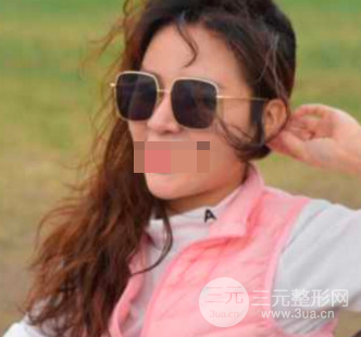 广西医科大学一附院植发价格